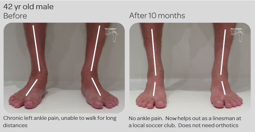 Natural Ankle Pain Treatment