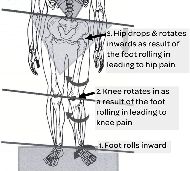 Hip Pain - Foot Posture Centre